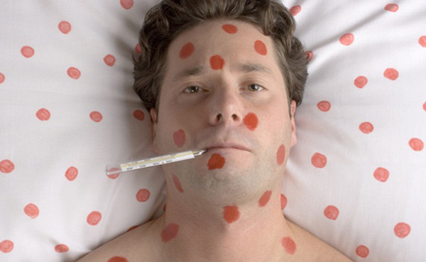 кір, щеплення