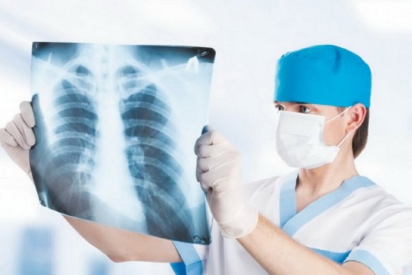 туберкульоз легень, Ніжинський район