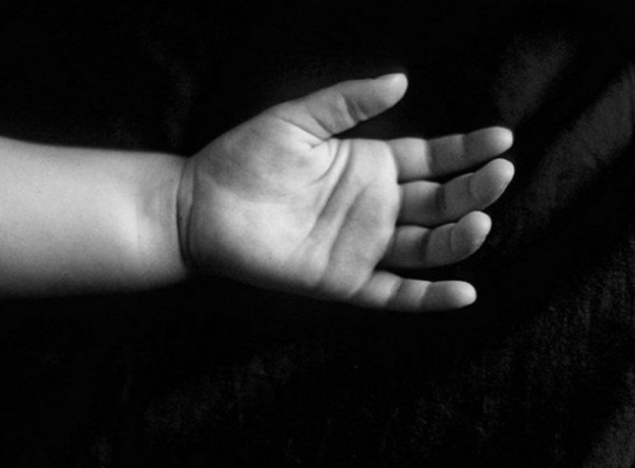 У Ніжинському районі від опіків померла 2-річна дитина 