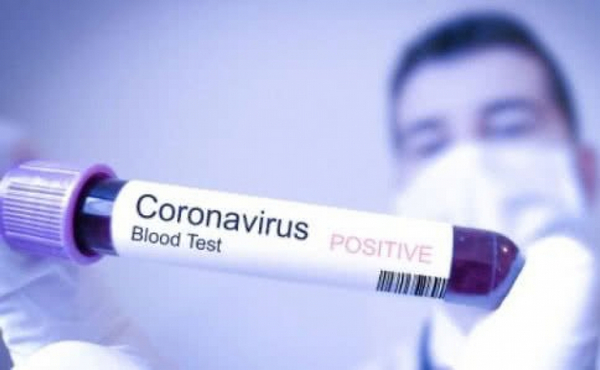 коронавірус, випадки, Чернігівщина